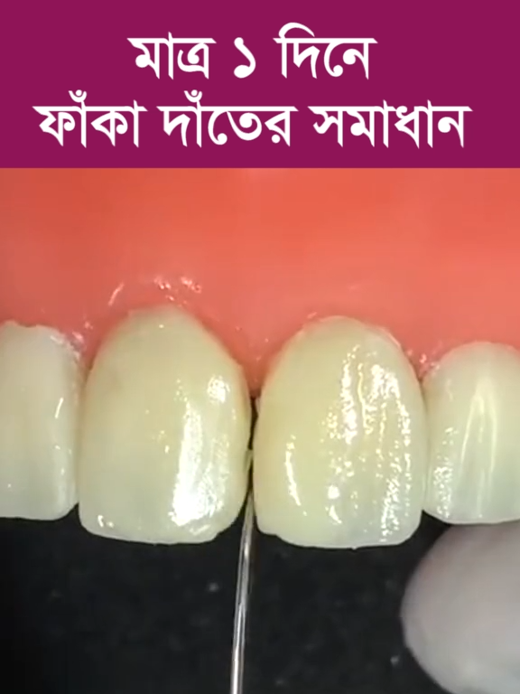 @Tech Dental