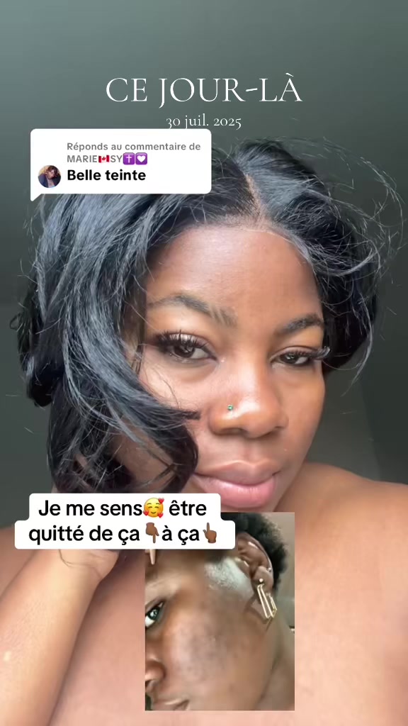 @Charnou🌸skincare🇨🇲