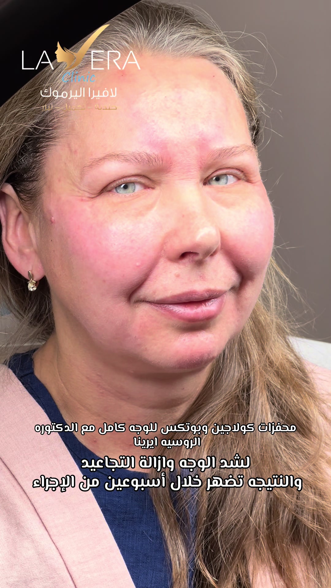 @عيادات لافيرا حي اليرموك