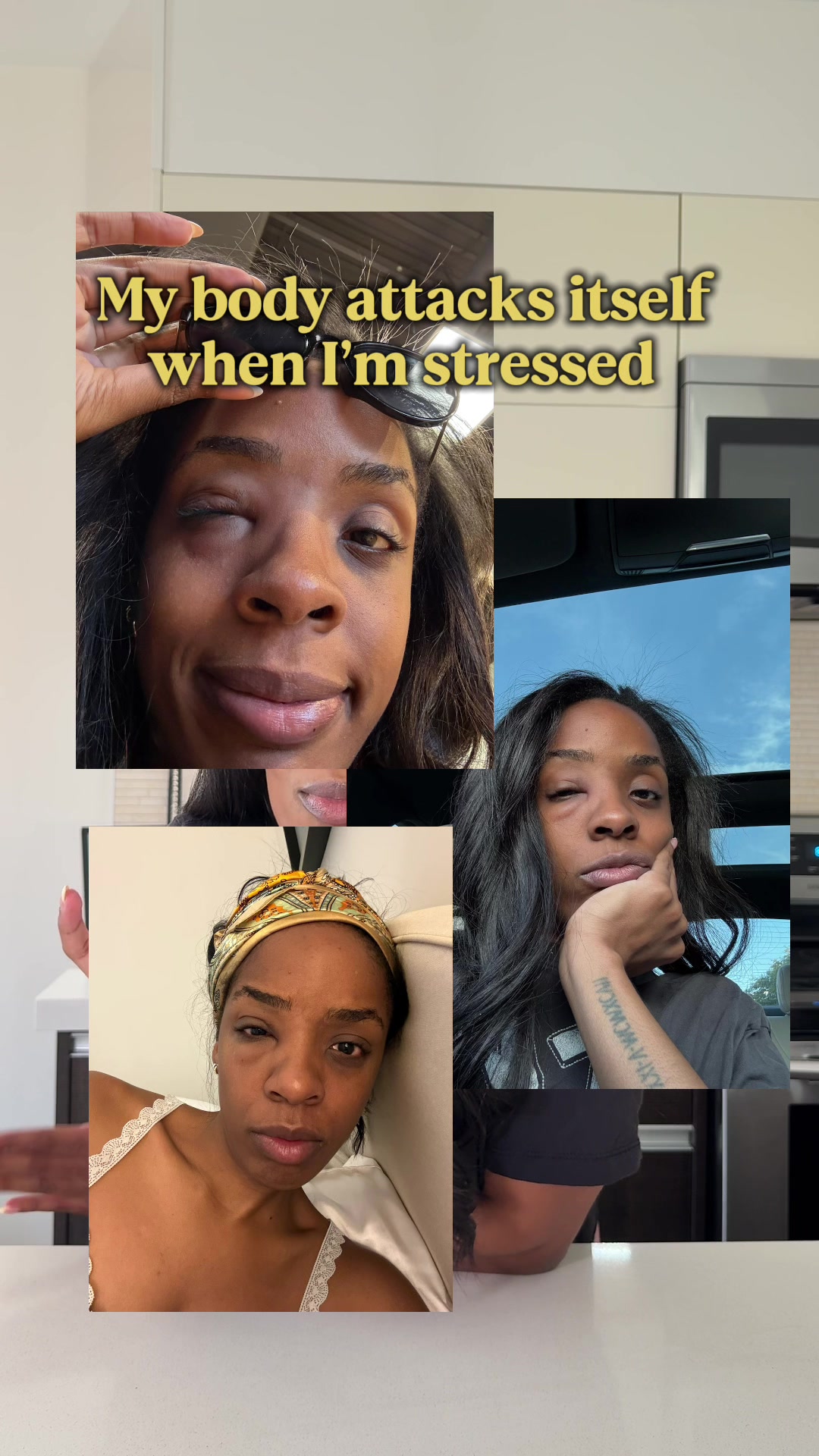 @Simone | Therapist🛋️💓