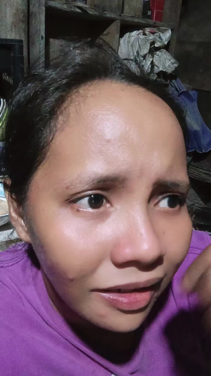 @bungal🤪✅