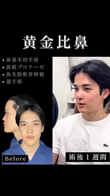 @ソ院長(バウム美容外科/トータル整形)