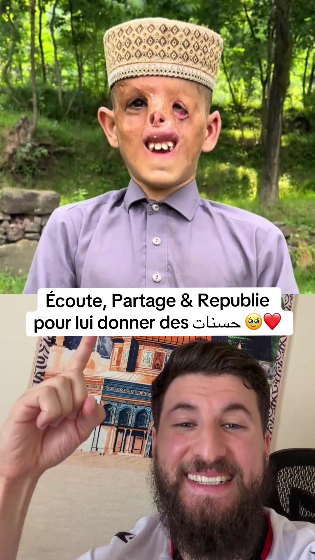 @Redazere