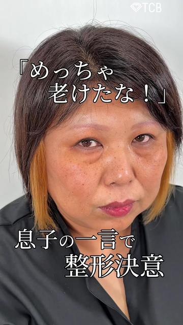 @【クマ取り/小顔整形】TCB京都駅前院 院長　橋本晋太朗