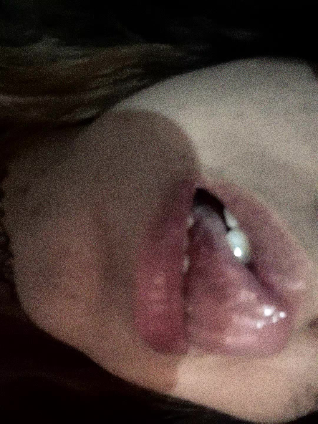 @Belu