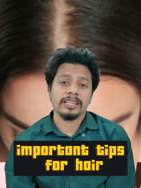 @NAZID HAIR TRANSPLANT