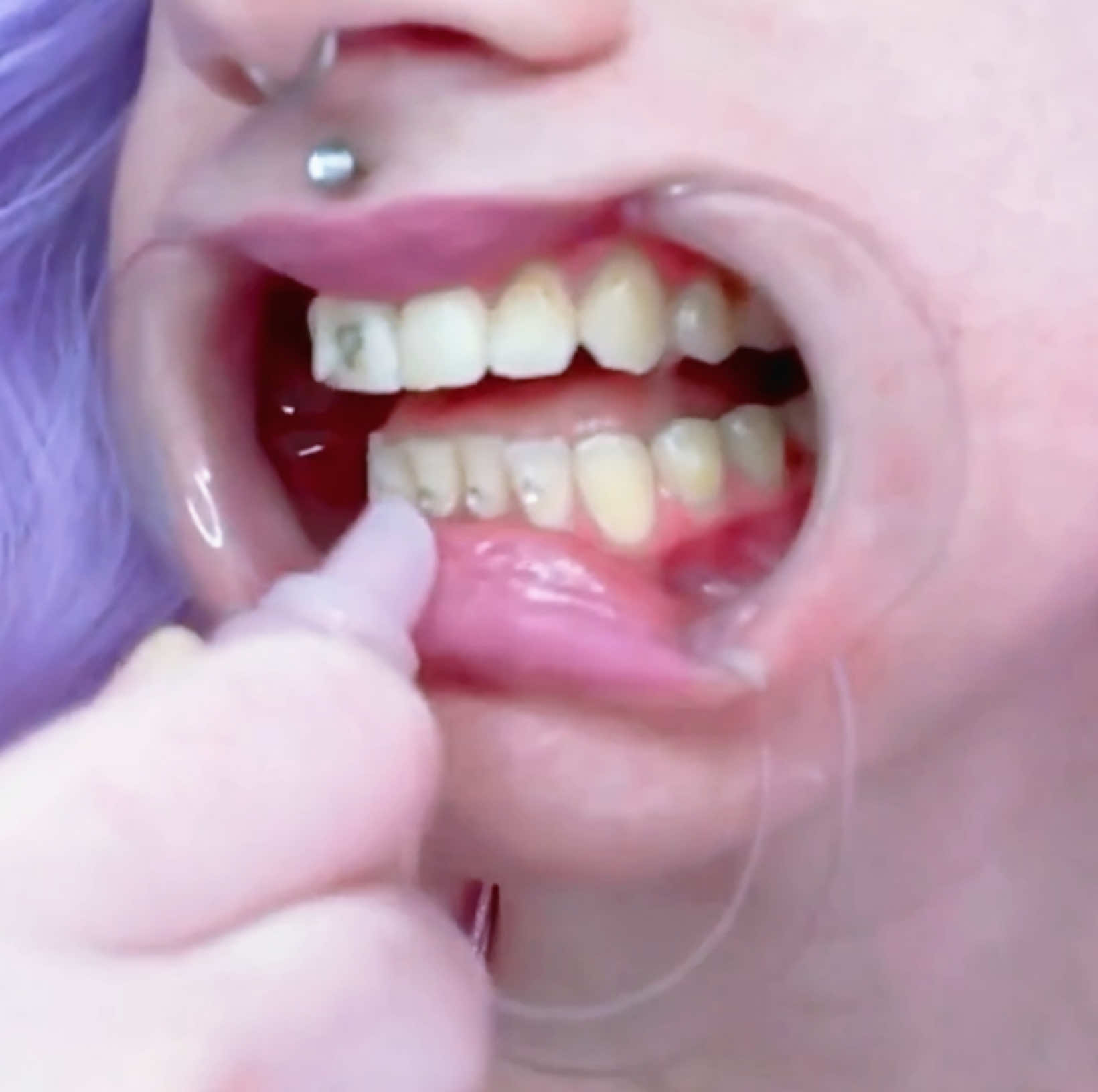 @TeethfairyEvah
