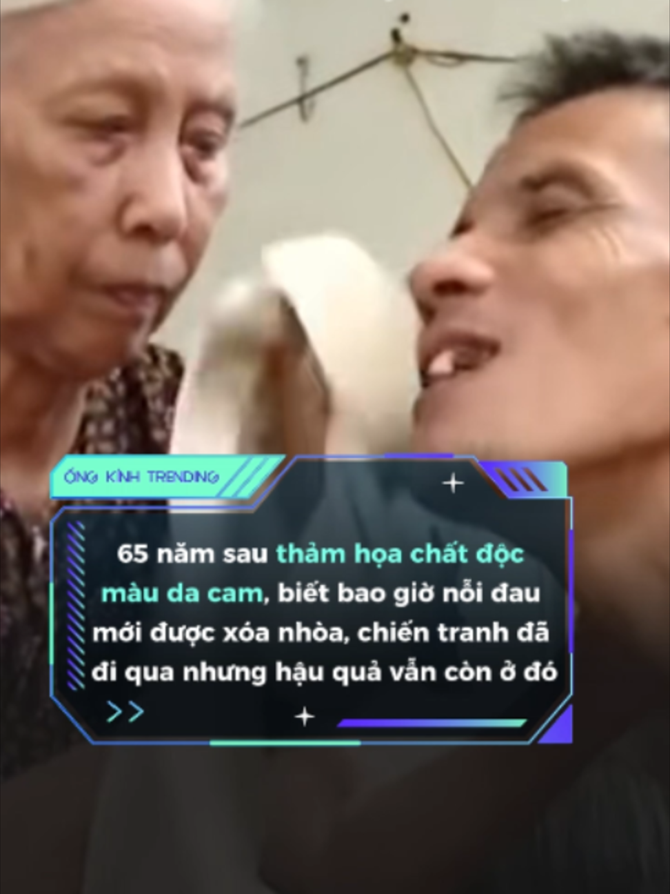 @ỐNG KÍNH TRENDING