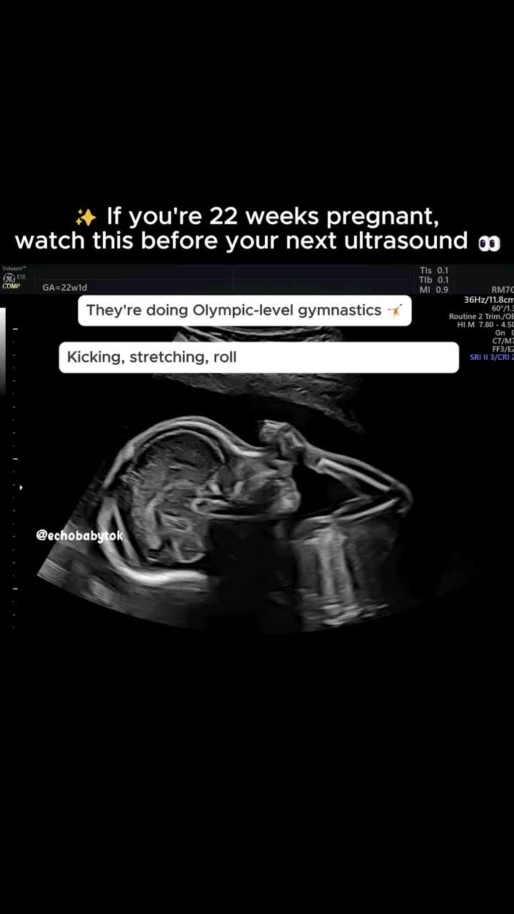 @Echobaby