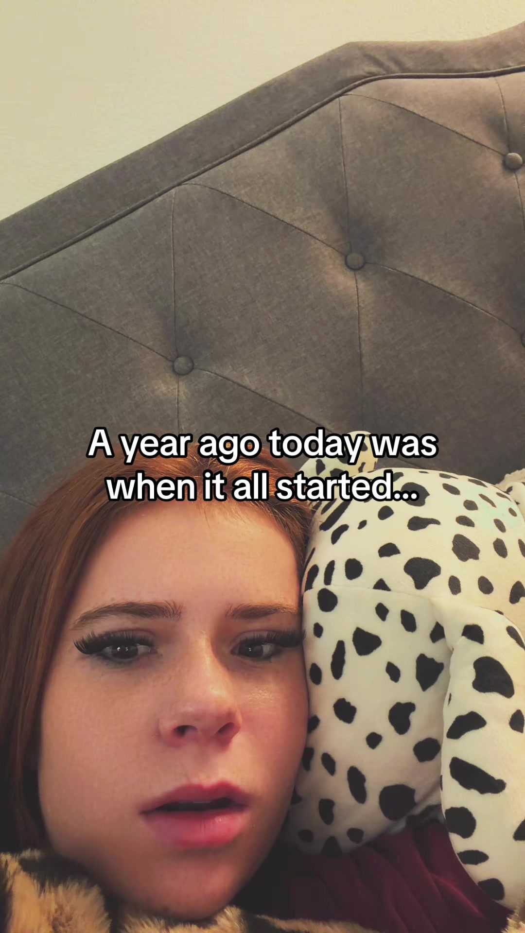 @harperpigmintation
