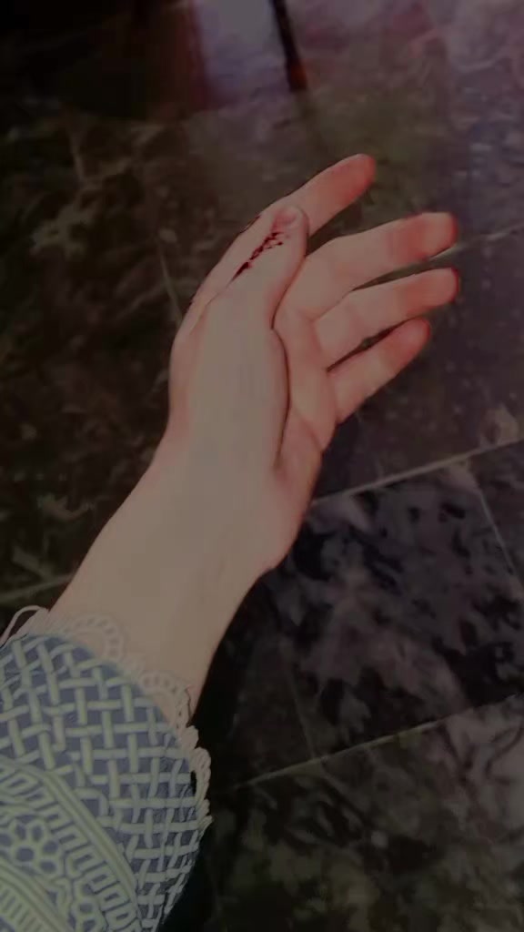 @𝒜𝓃𝑜𝑜.𝓍𝒾𝓉𝓏🥀