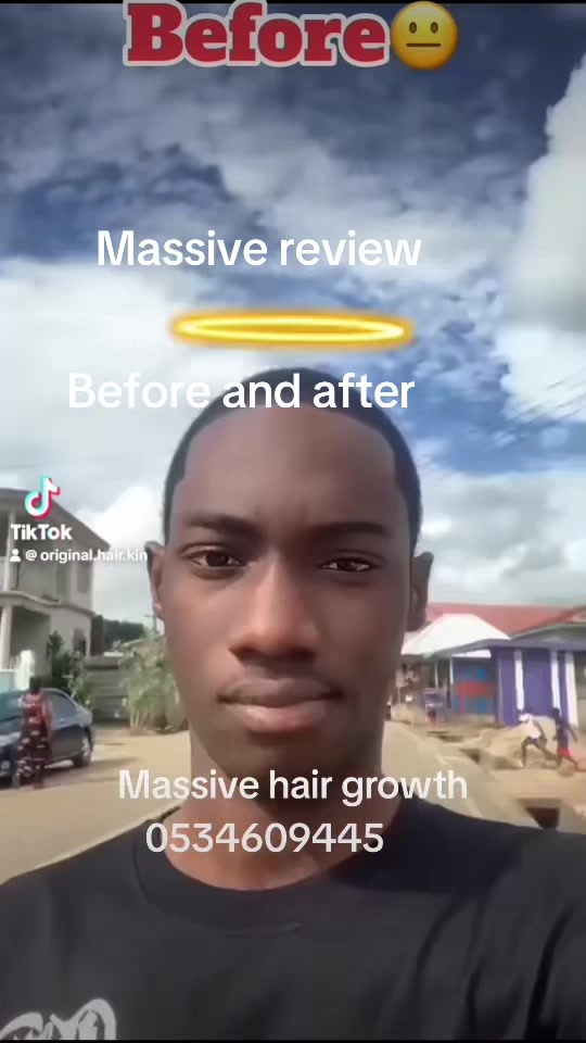 @Original.hair.kin 32