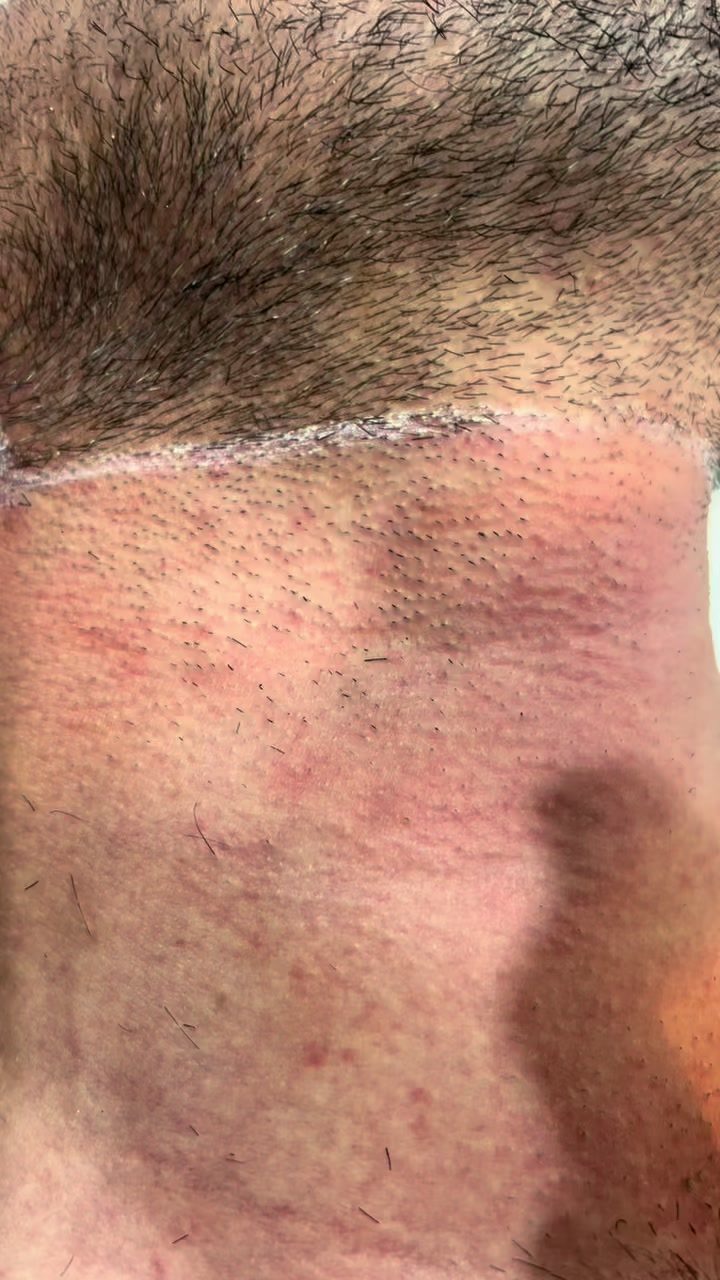 @Laser Grafix clinic