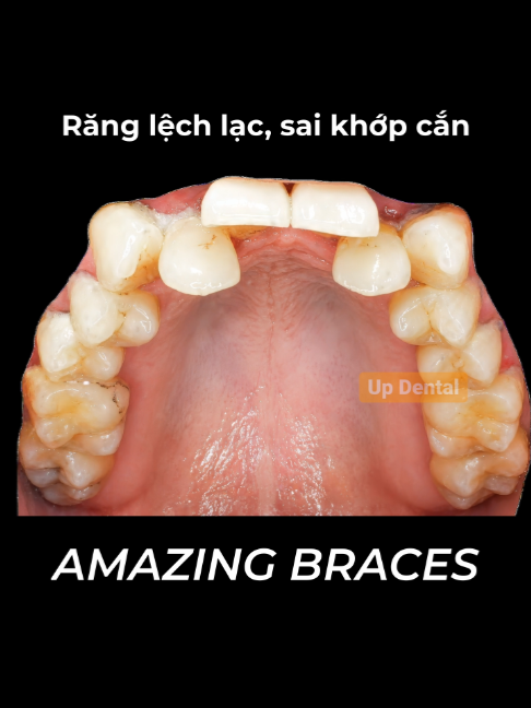 @Nha khoa niềng răng Up Dental