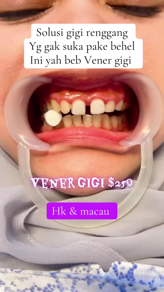 @mbak-Paijem