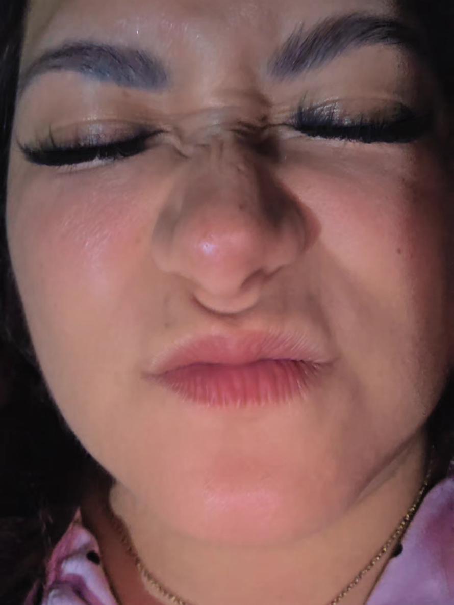 @zetinaa