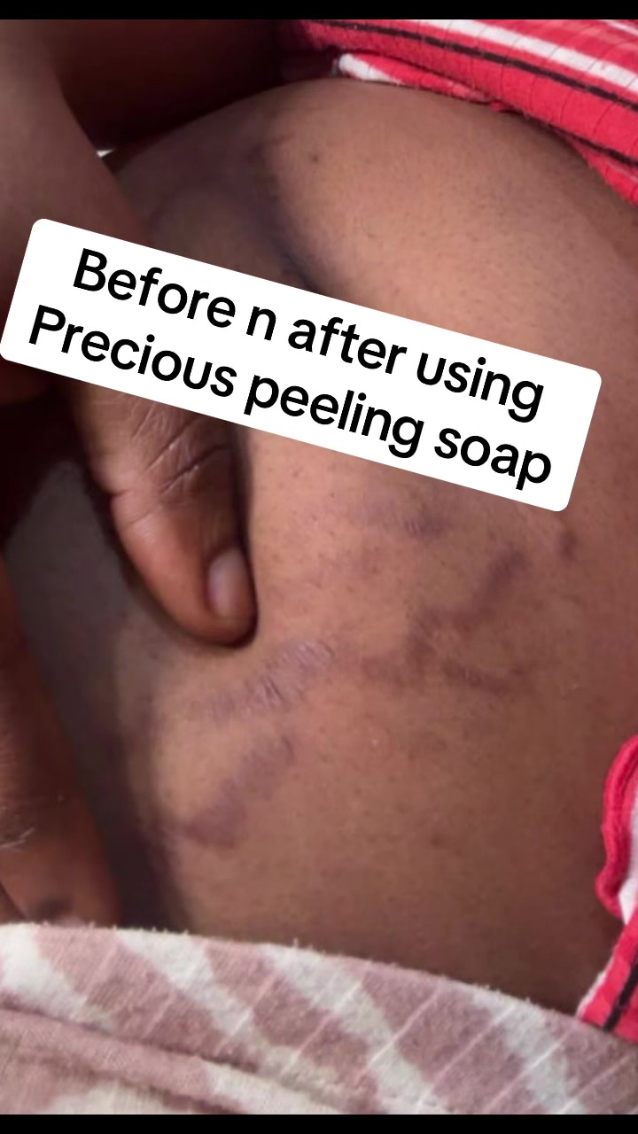 @@ Precious peeling soap
