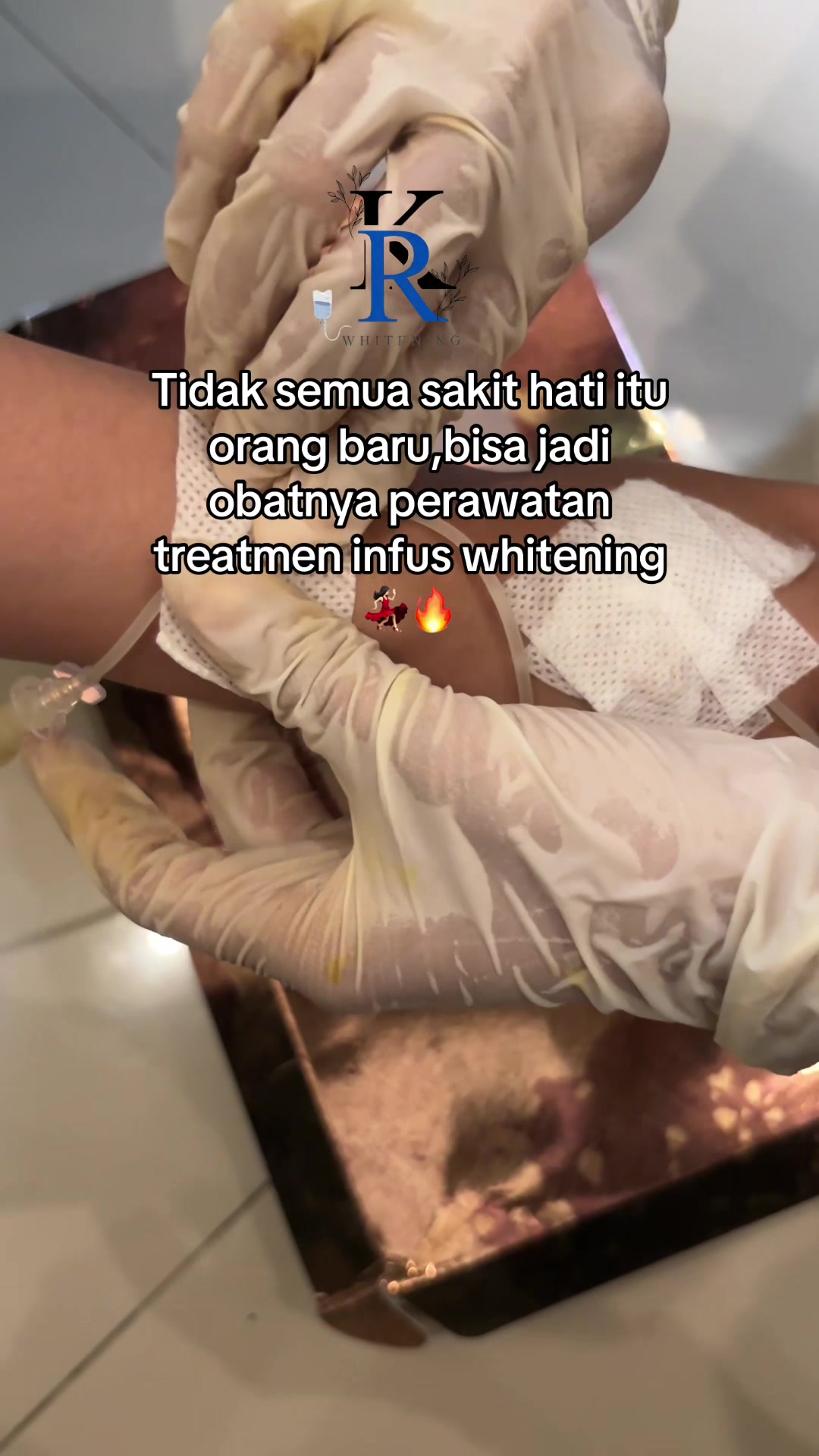 @RK WHITENING
