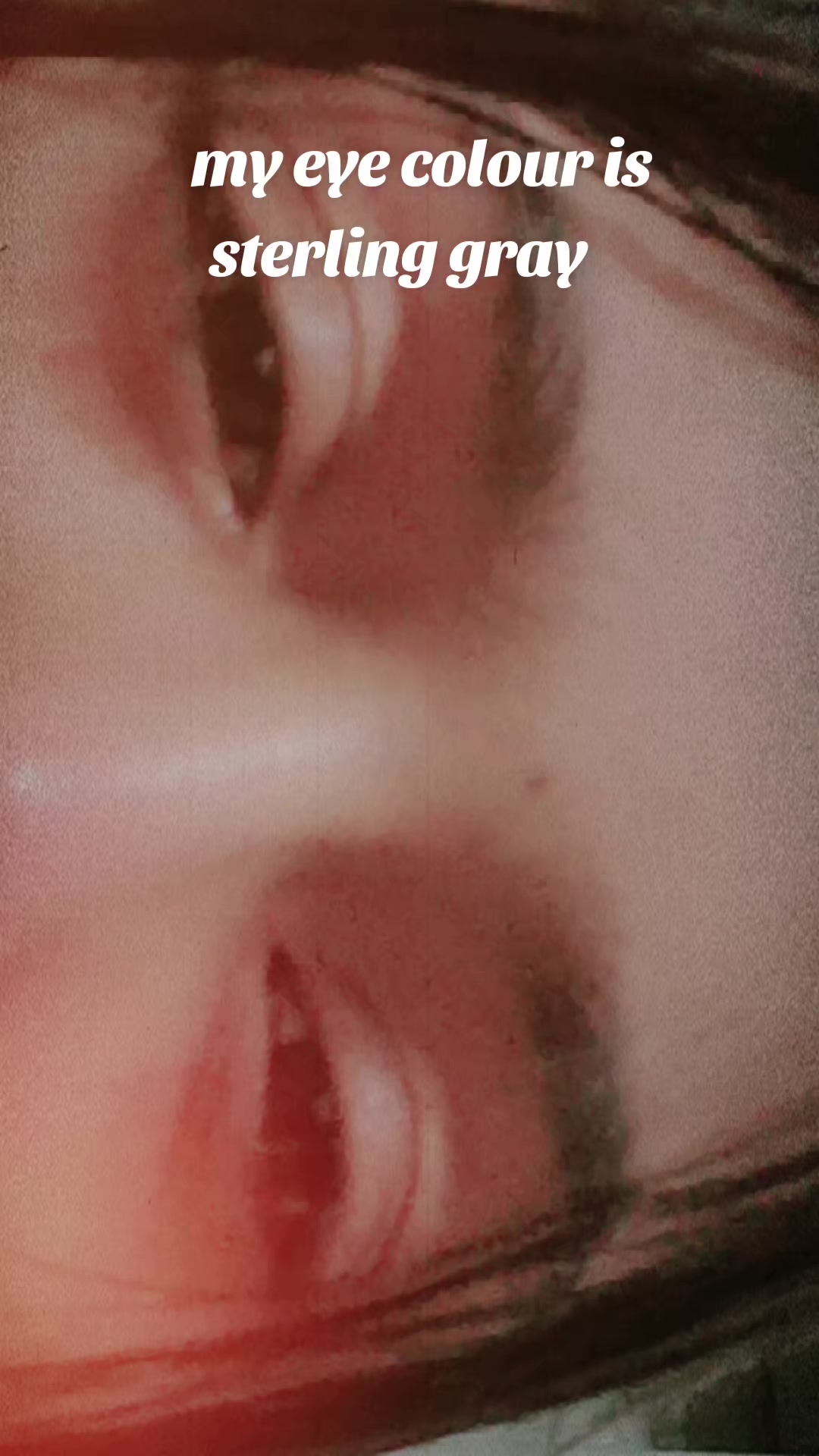 @@๐ฟ๐_๐๐ผ๐๐๐ฝ๐ผ๐ฉบ๐ฅผ