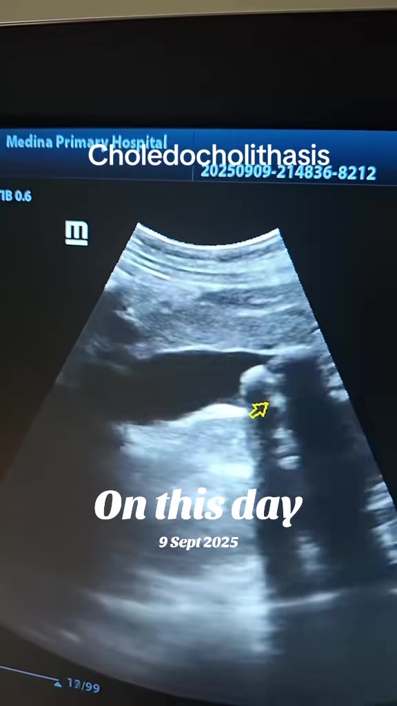@Dr Wubie Endalew(Radiologist)