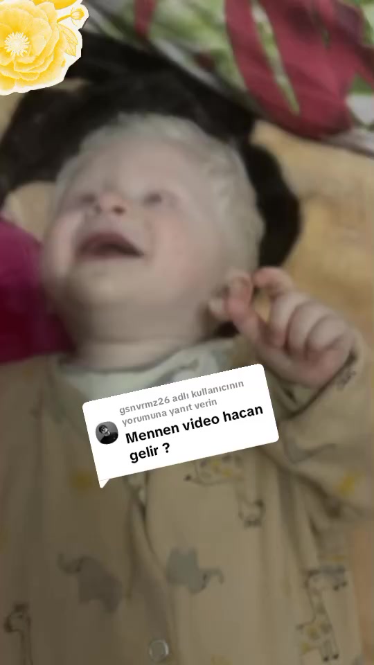 @🧸🤍ALBİNO🤍🧸🤍RAUL🤍🧸