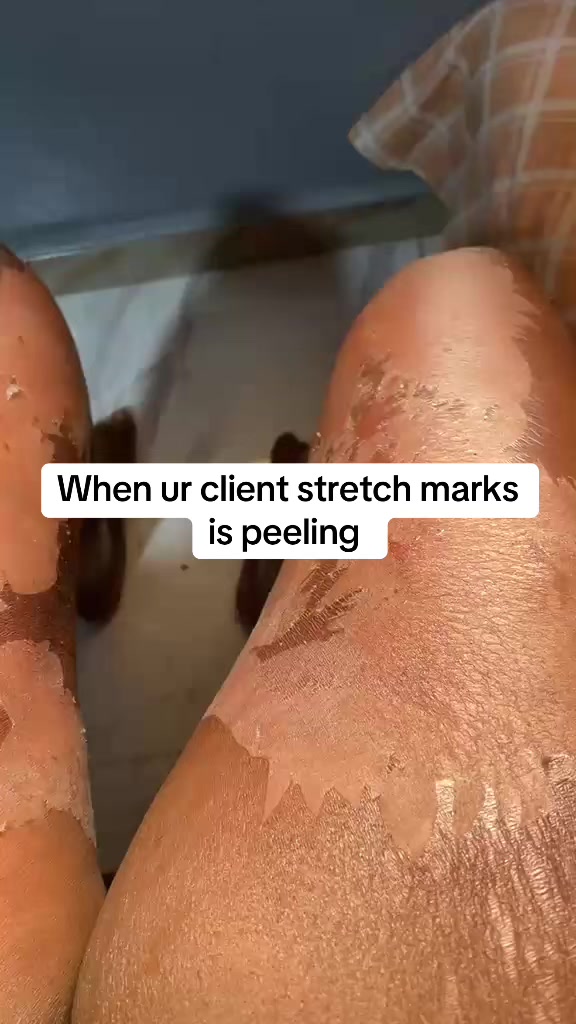 @@ Precious peeling soap