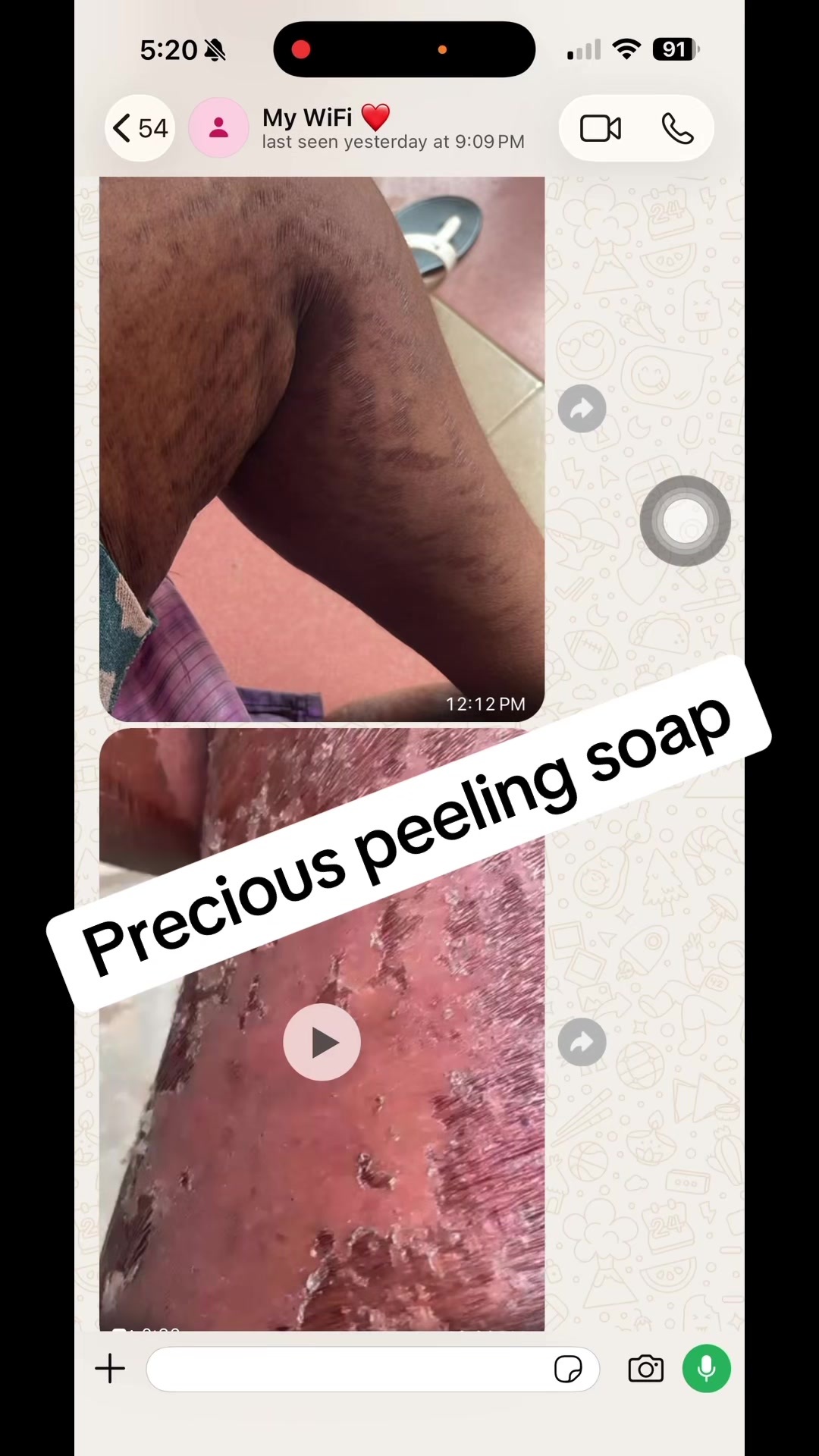 @@ Precious peeling soap