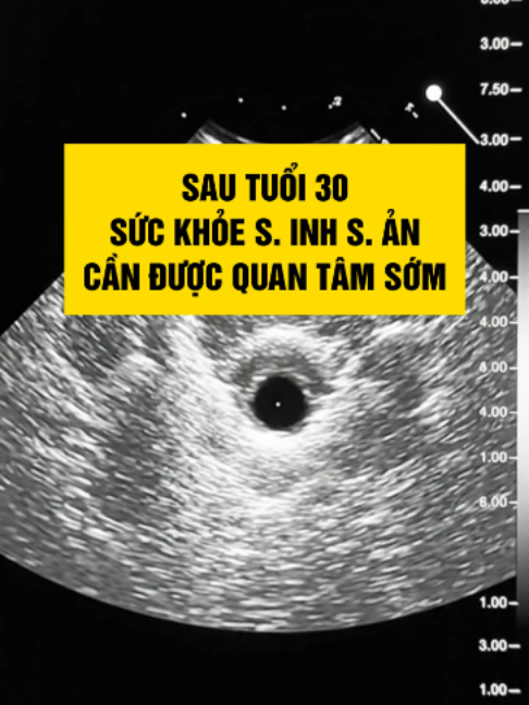 @Phùng Hà canh trứng mát tay