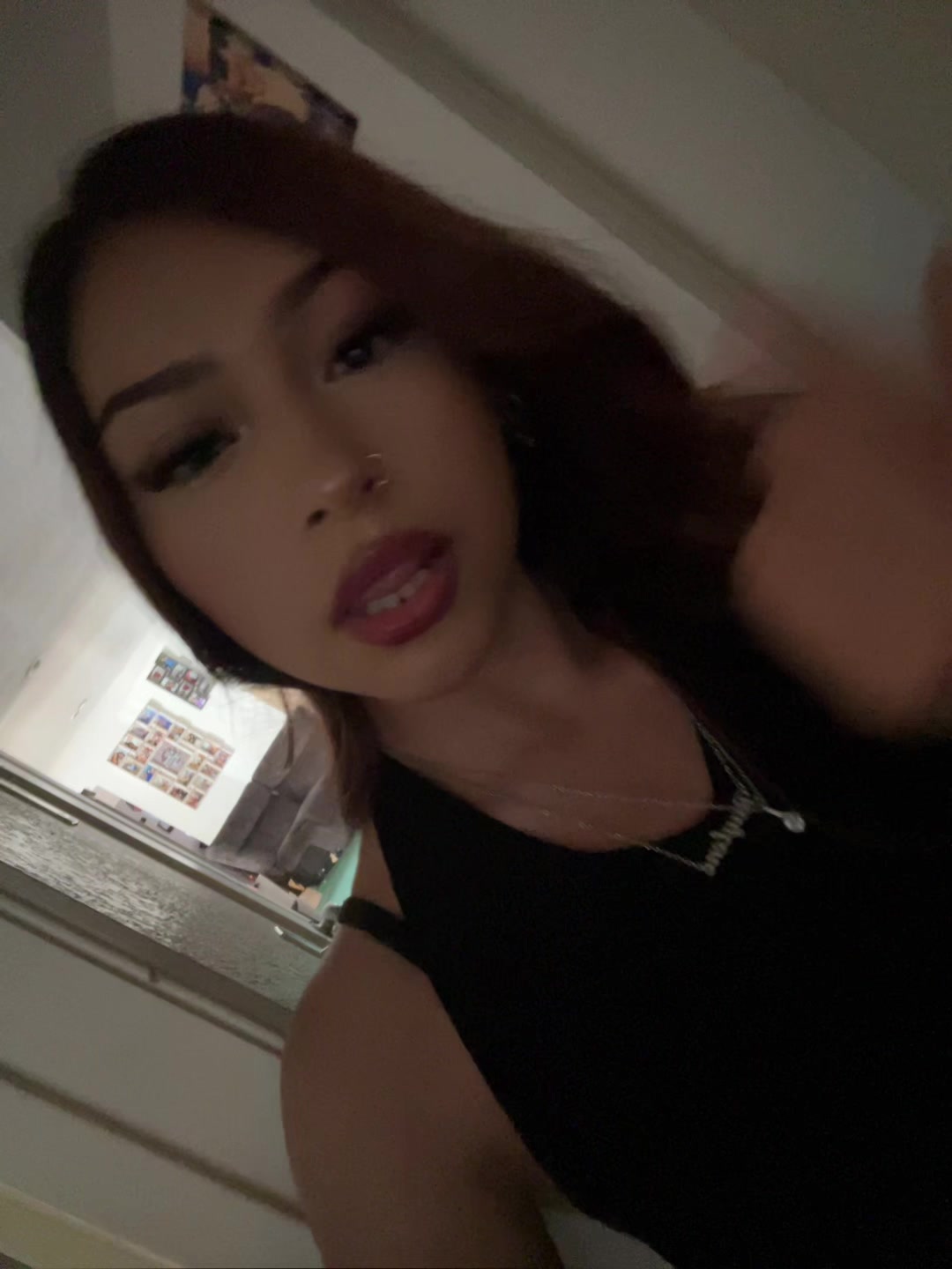 @unknown.ray.10