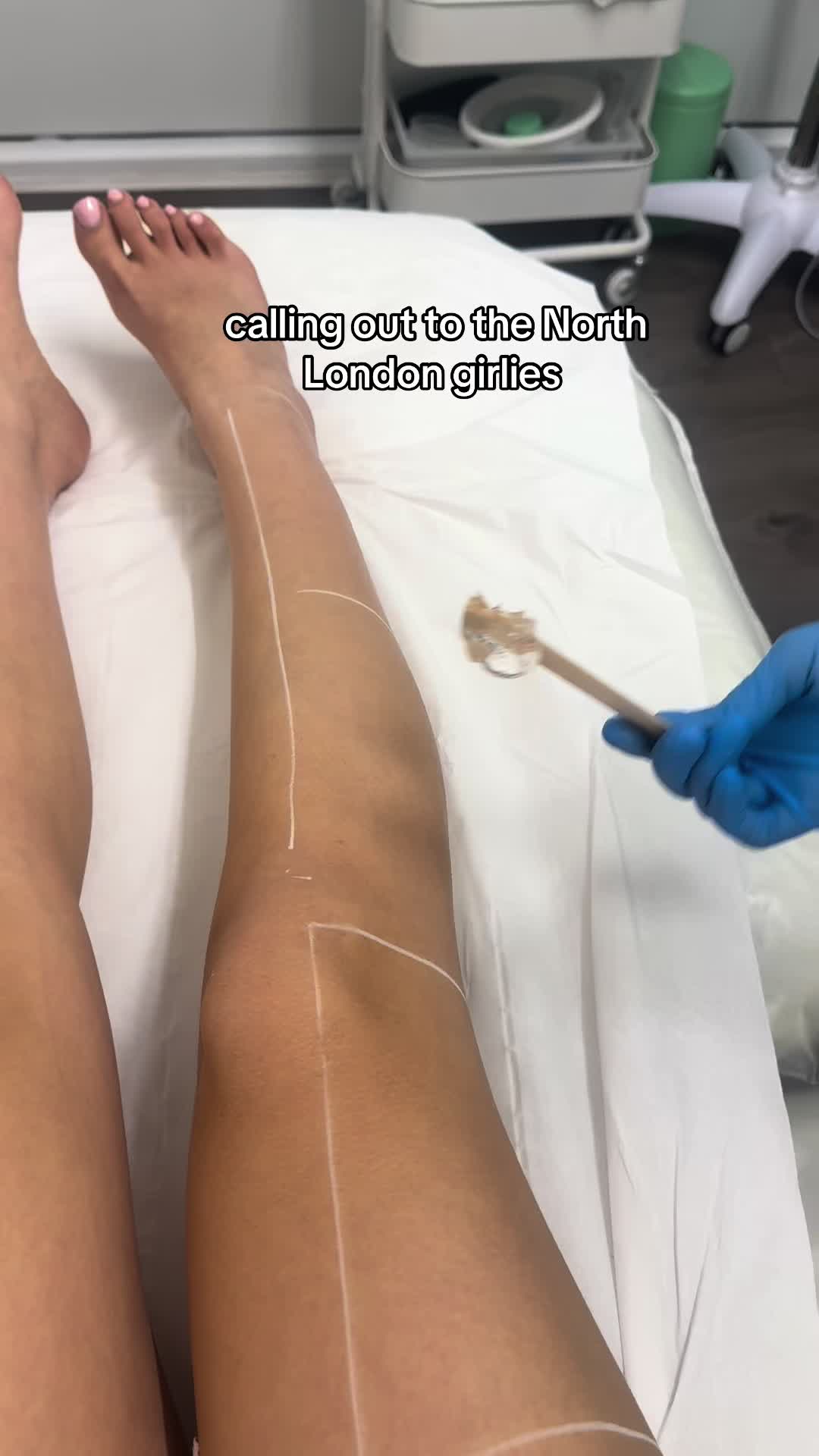@London Laser and aesthetics