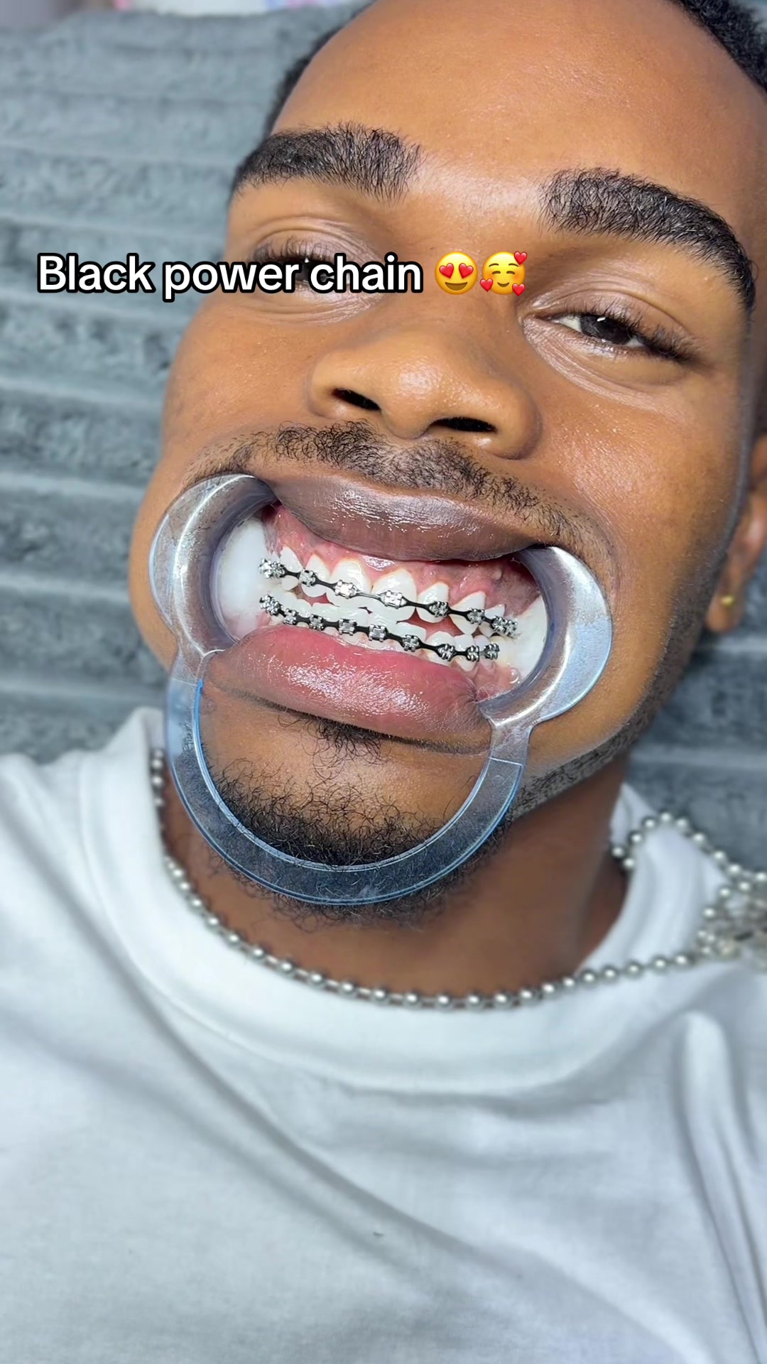 @Toris aesthetics