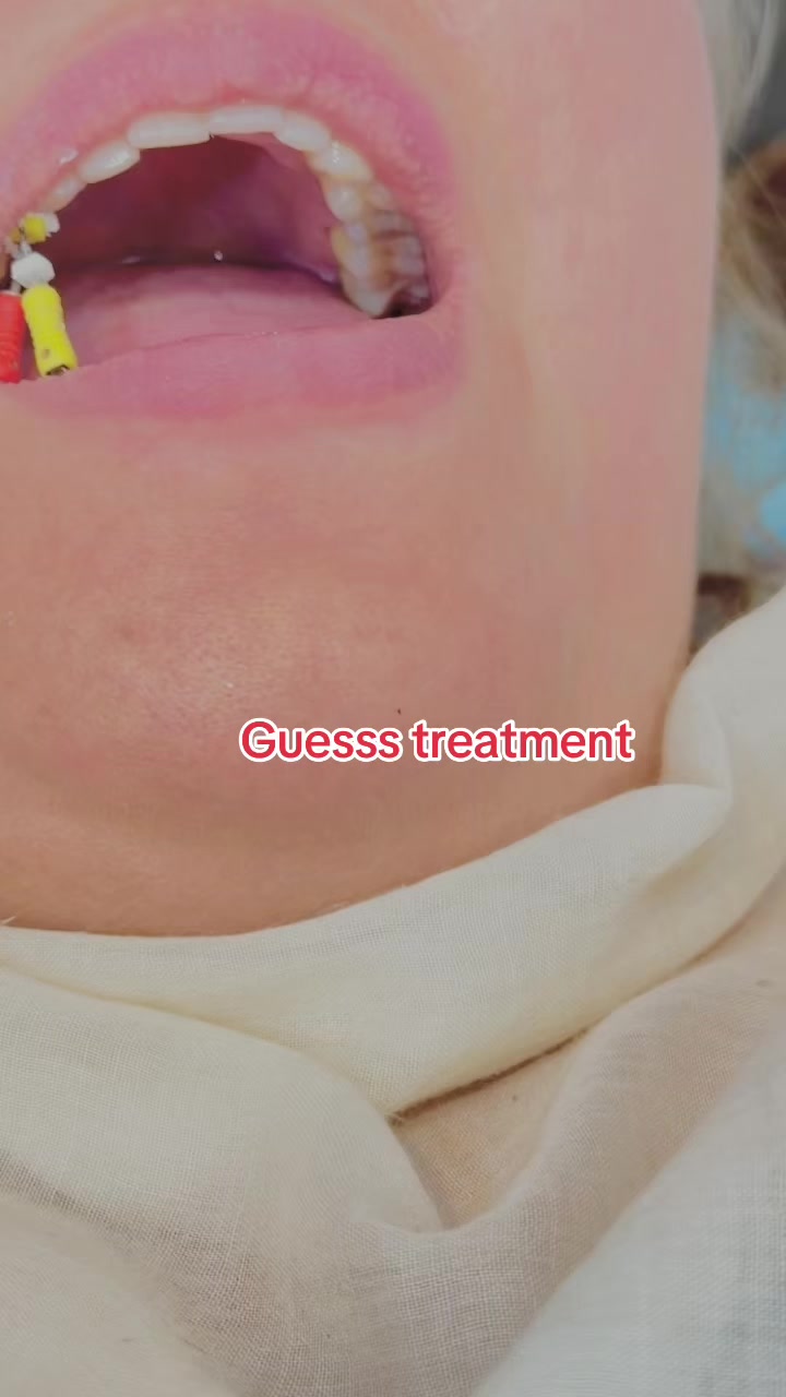 @Dr__Anmoll🦋🦷