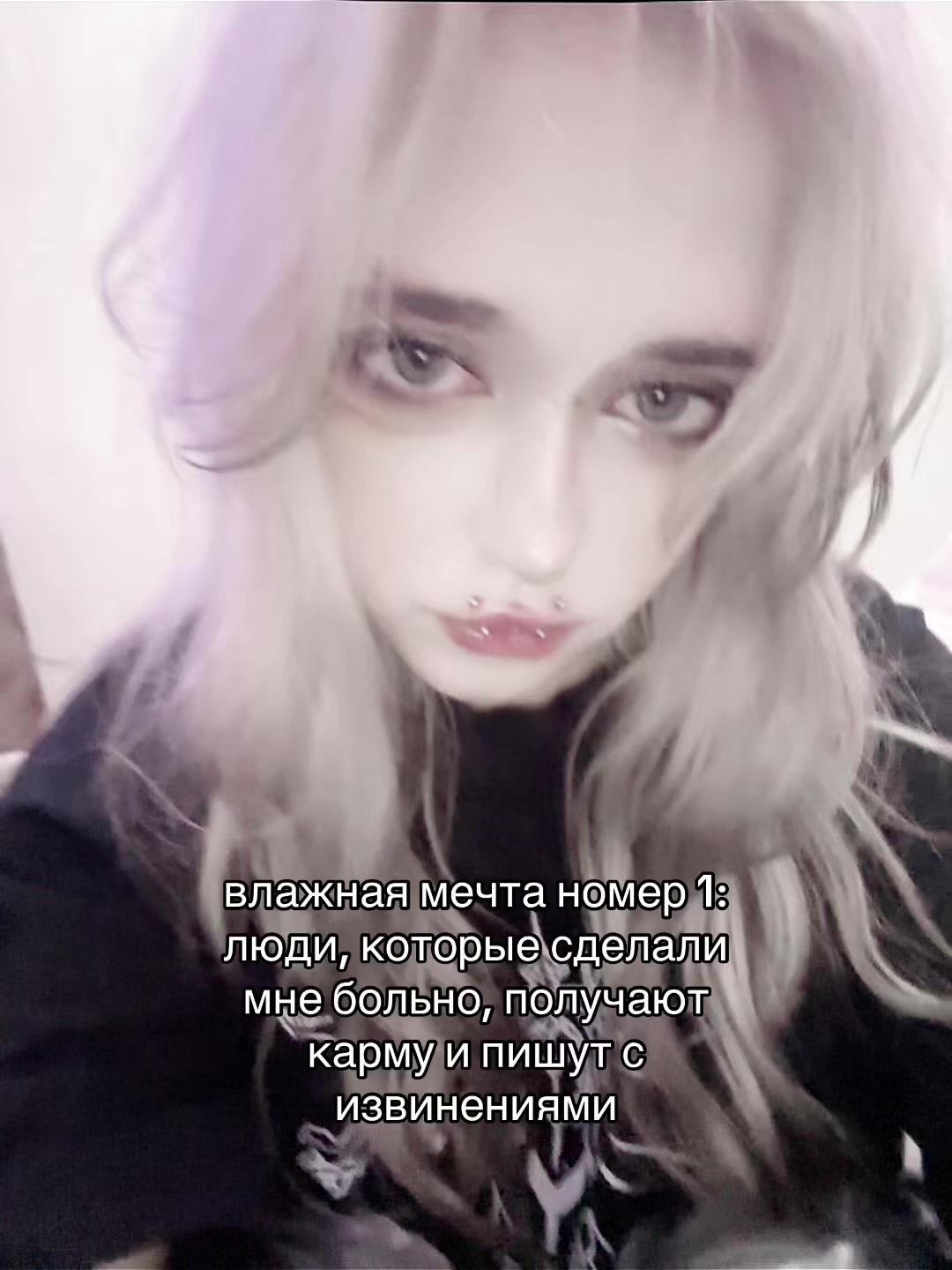 @uglyrosis