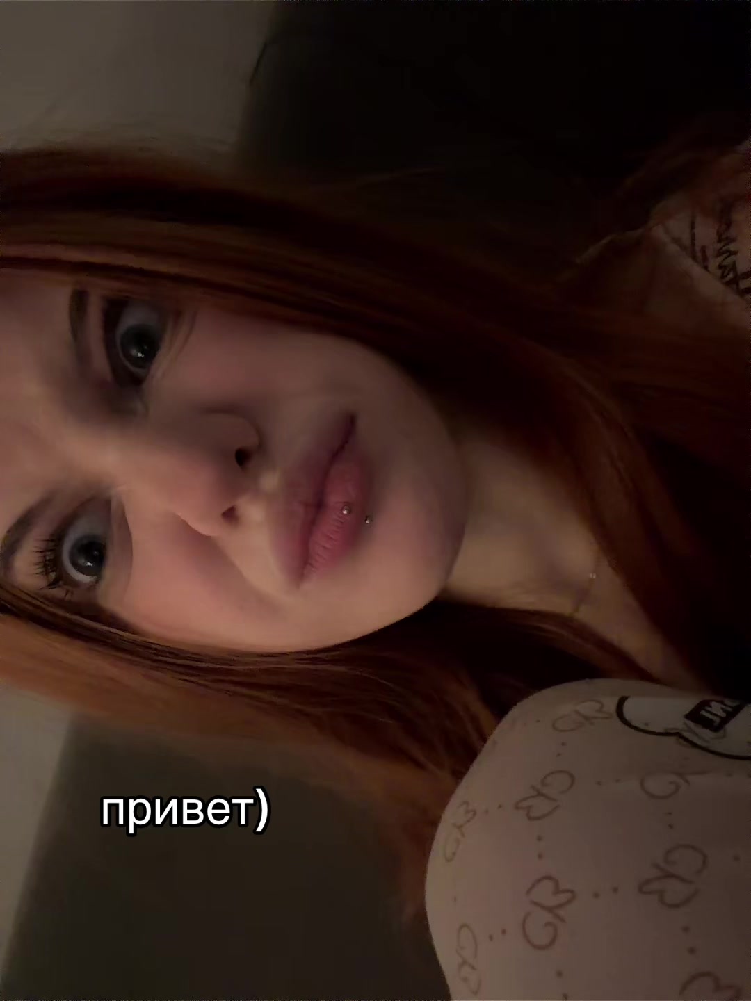 @глаукома