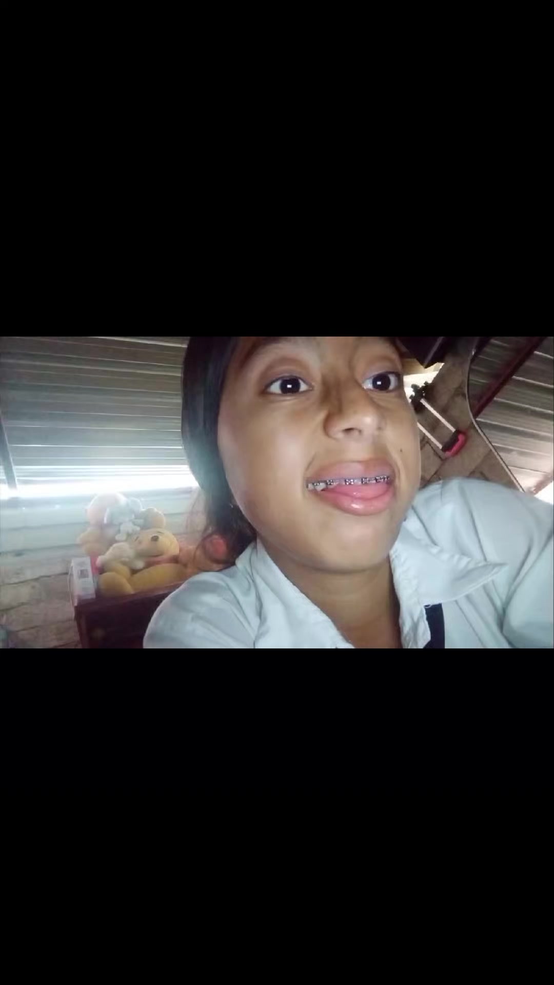 @BALESKA MENDOZA 💋