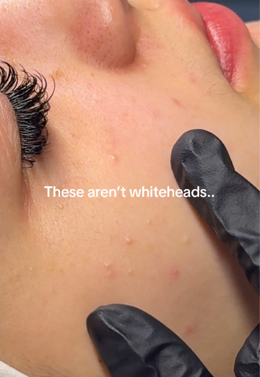 @Skinformative