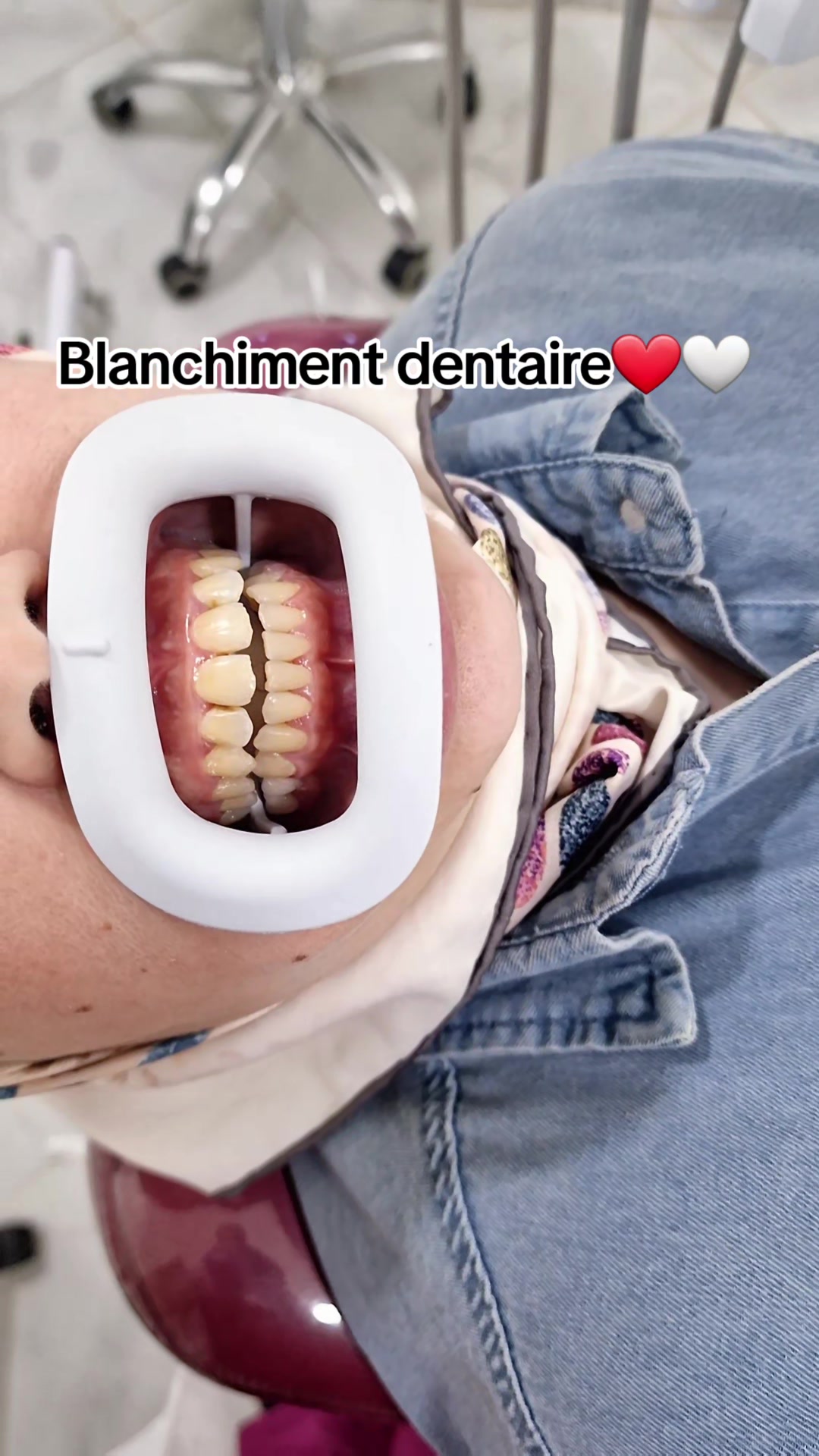 @Dr otmani. A 🦷🖤
