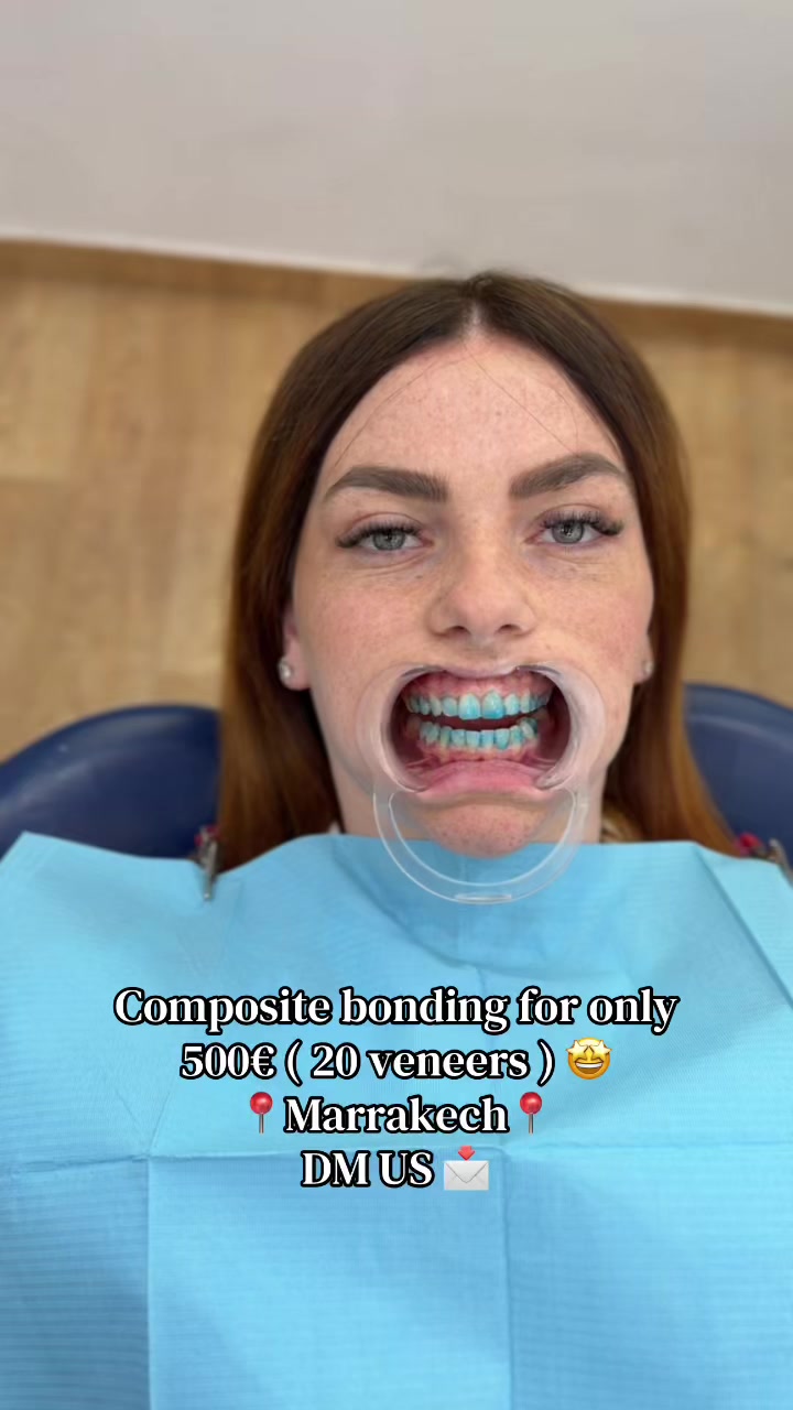 @Smilesecret
