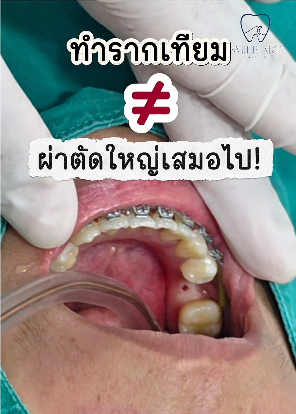 @smile Art Pattaya