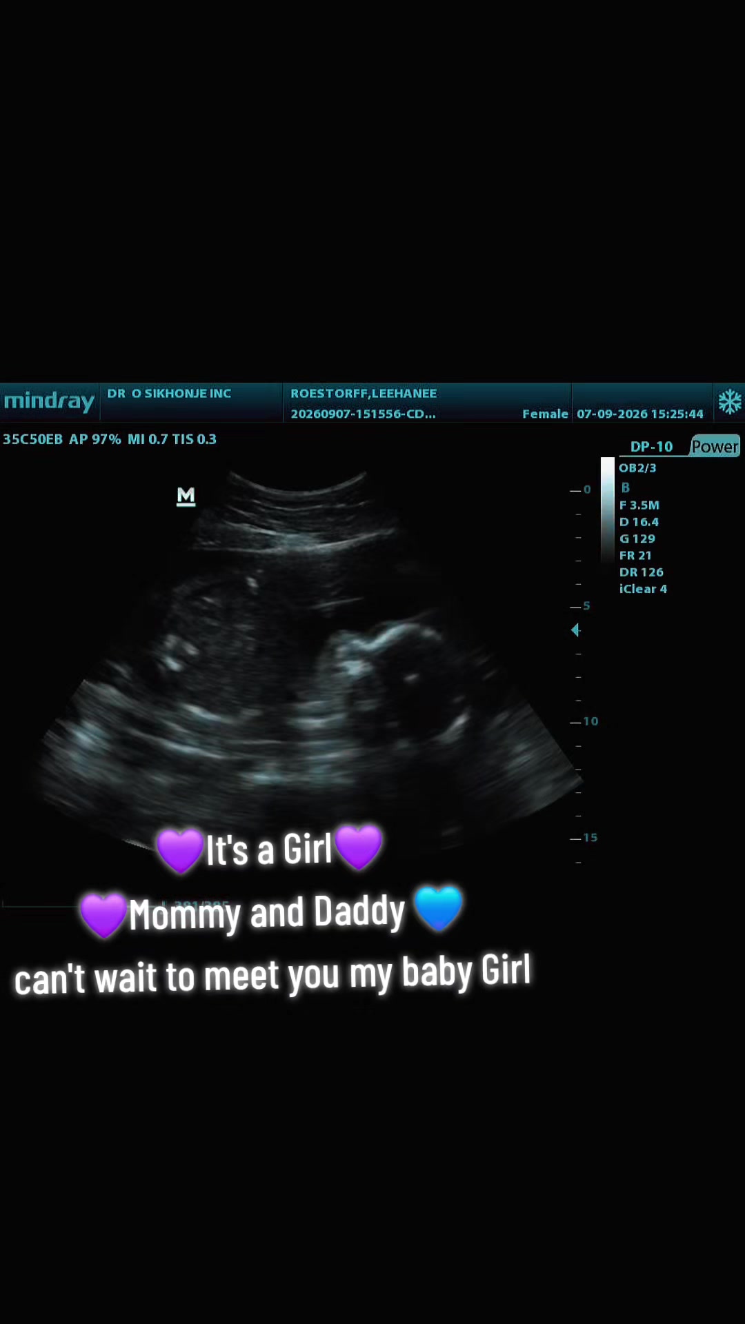 @💜👻shadow mom to be👻💜