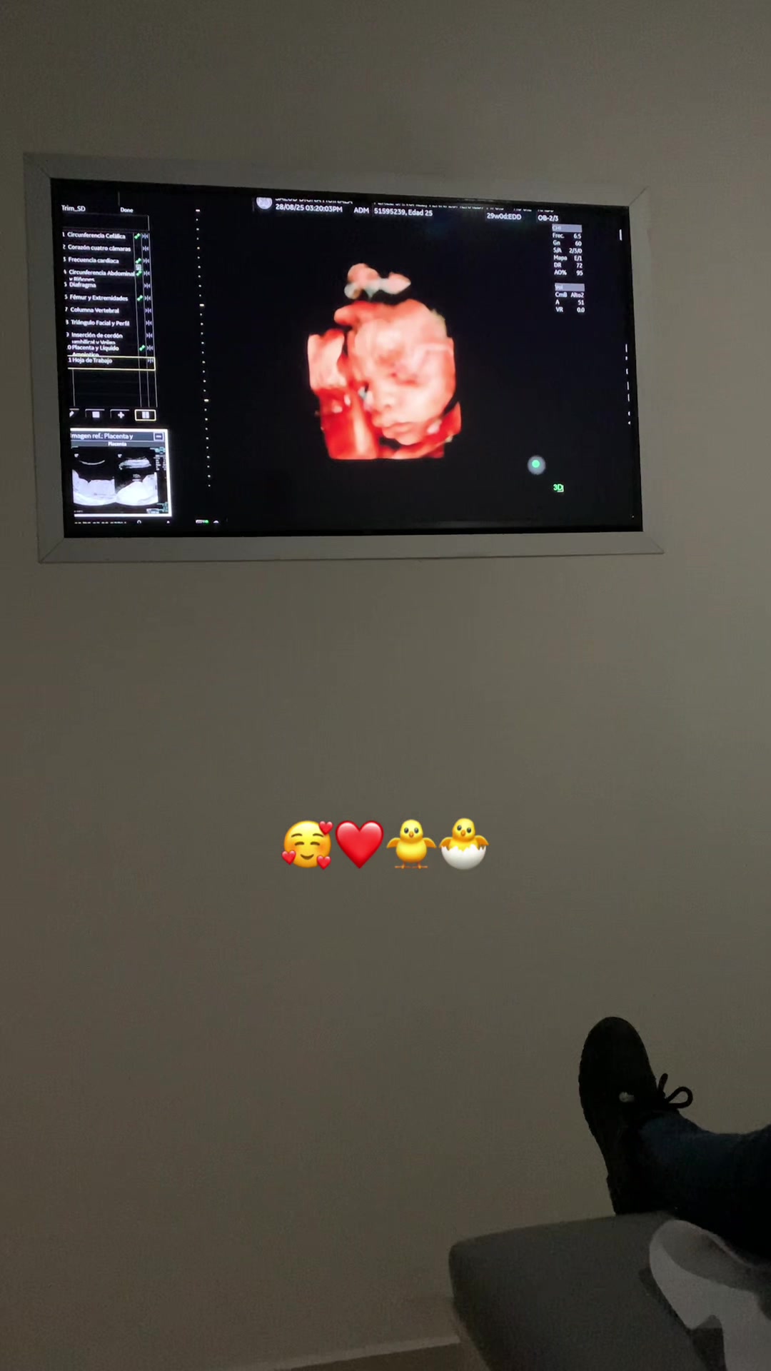 @El Chuy 🐣