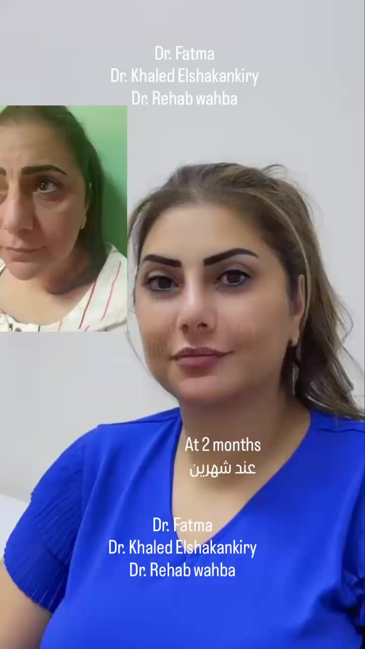 @Dr fatma & Dr Rehab Wahba