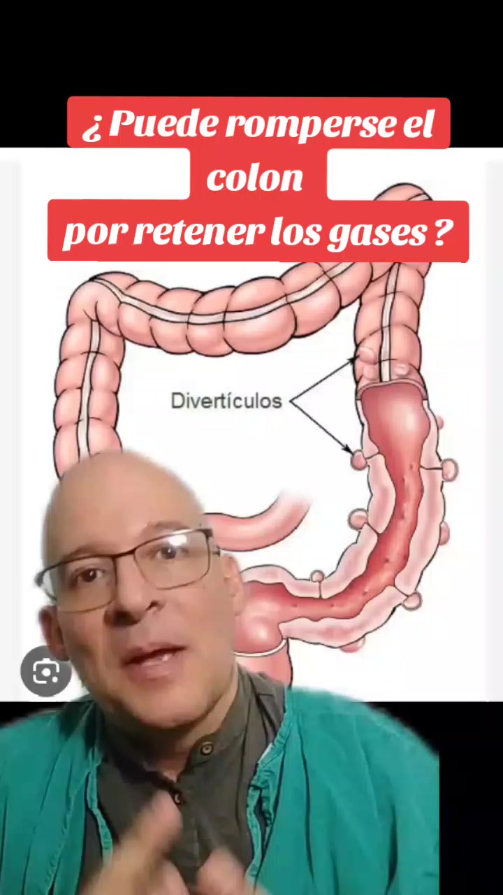 @Ray