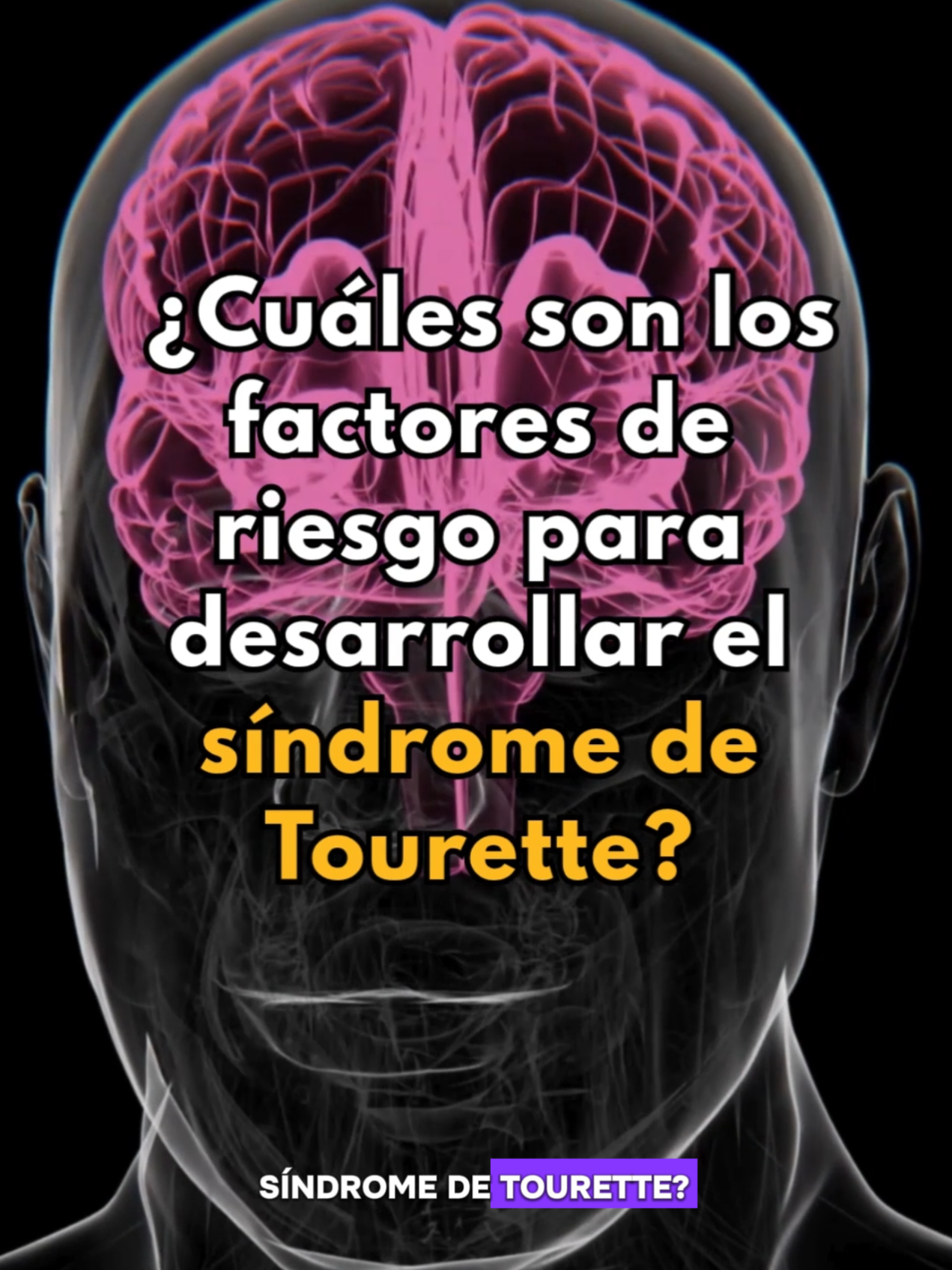 @Aula MEJOR
