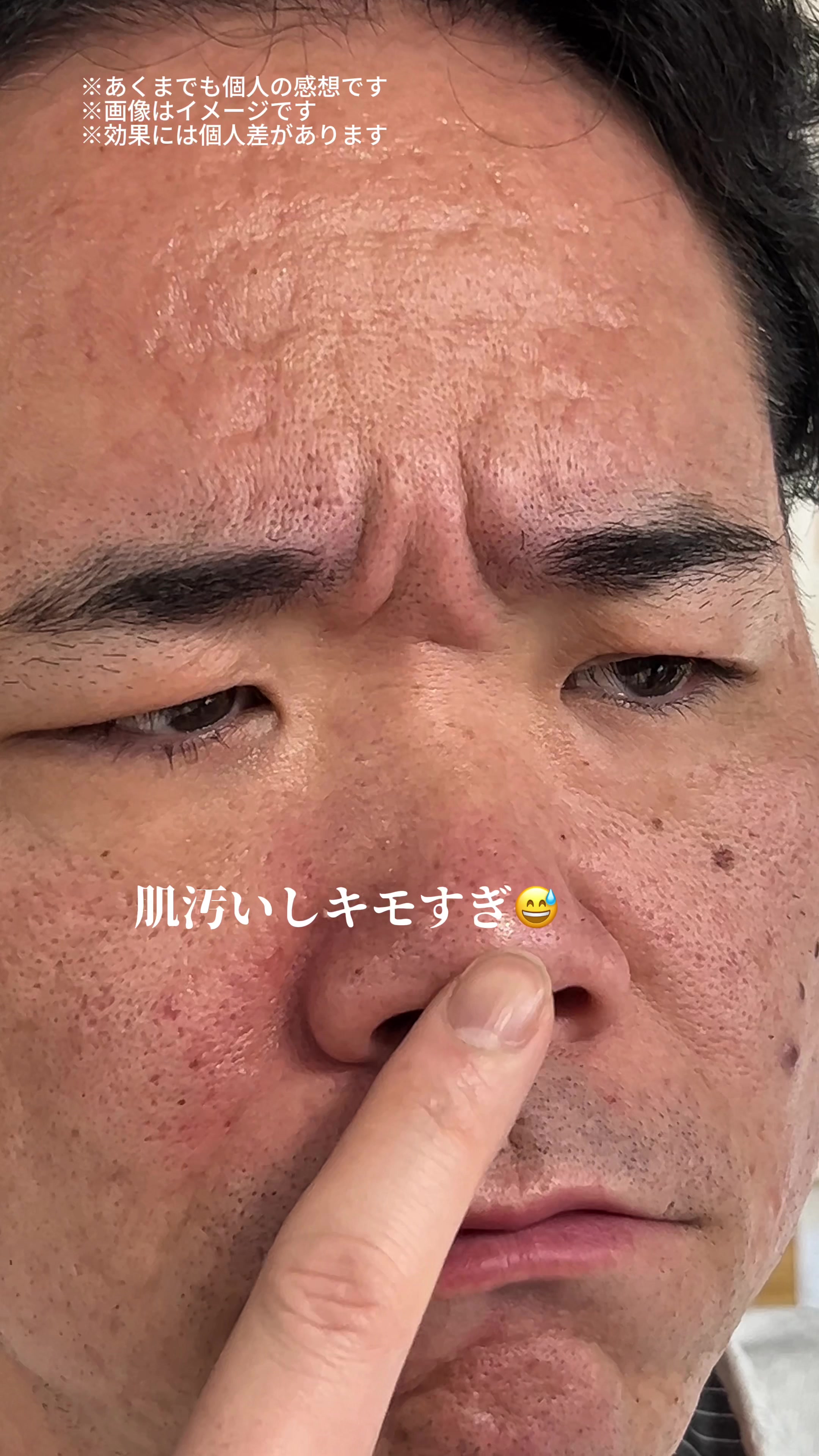 @キルア