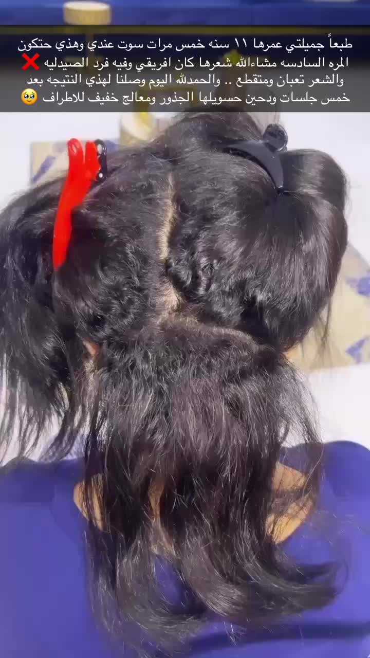 @أسماء | خبيرة معالجات الشعر🌷.