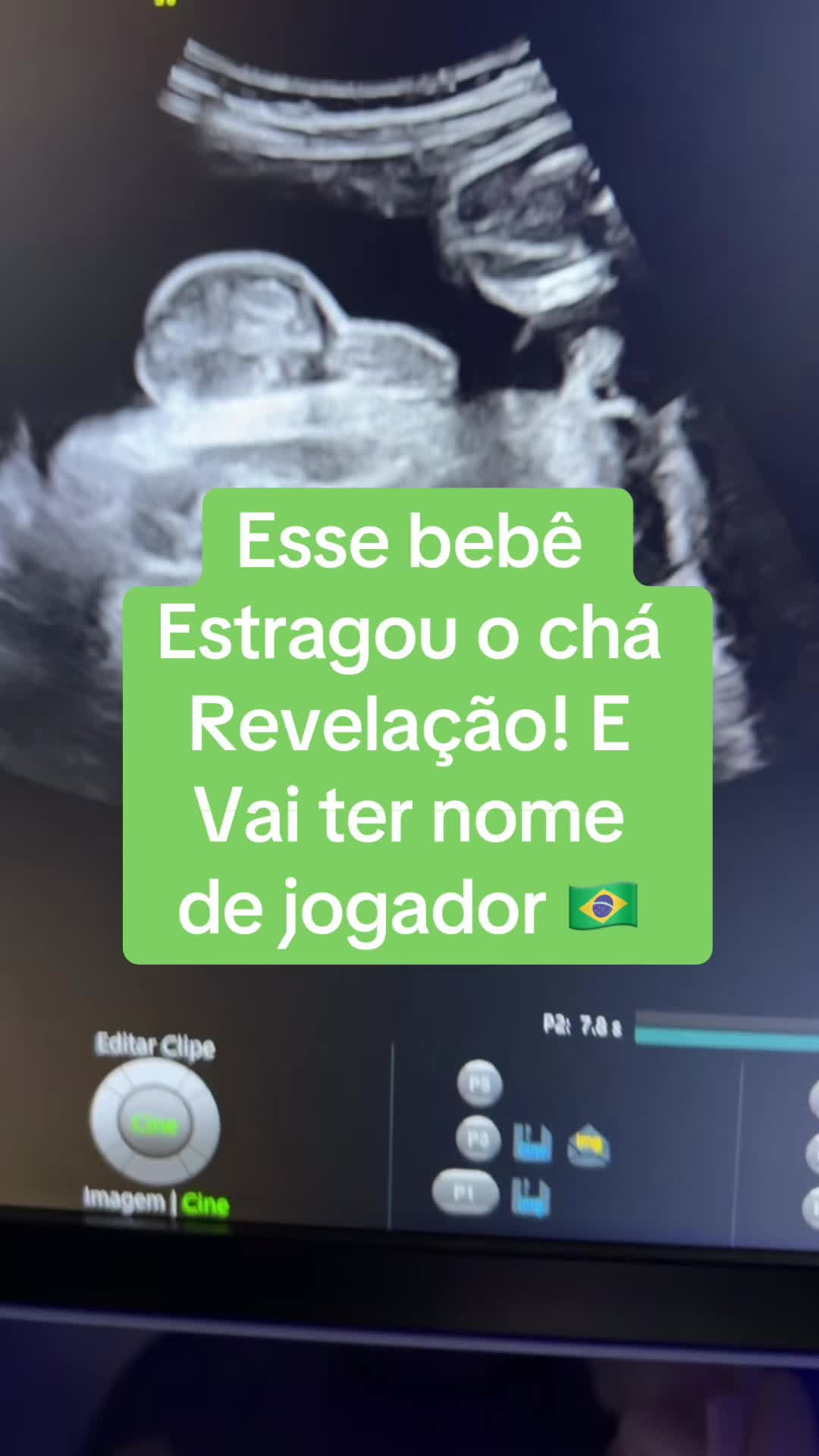 @Dr Alex Alexandre