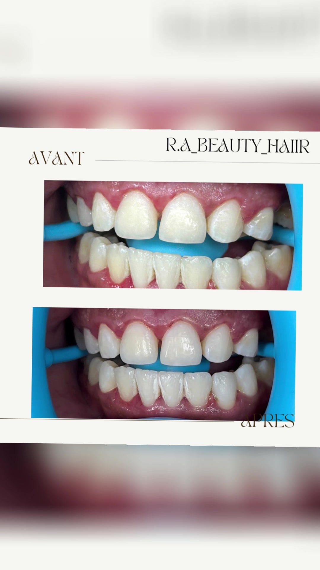 @R.a_beauty&haiir