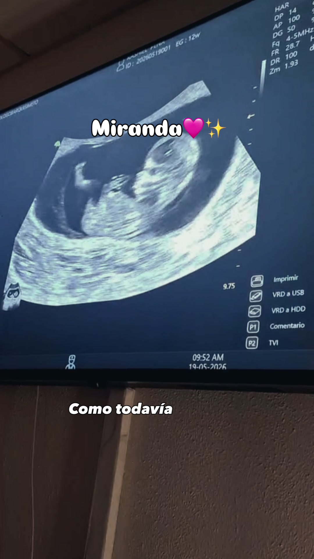 @𝘙𝘢𝘴𝘩𝘪𝘦𝘭𝘮𝘢𝘬𝘦𝘶𝘱♡