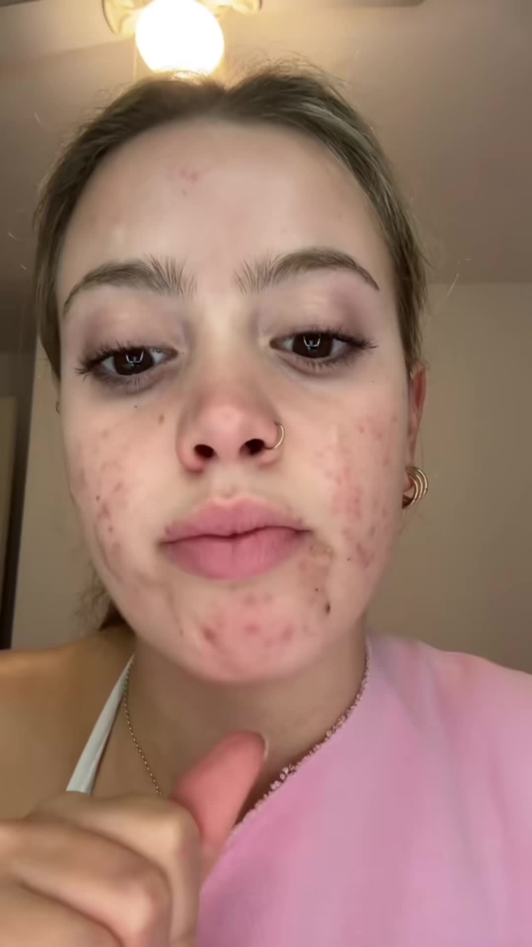 @cheeto🙈